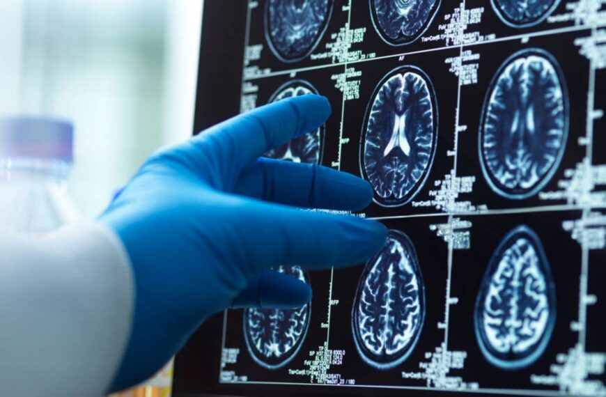 Menopause ‘triggers loss of brain matter which could explain women’s higher dementia risk’