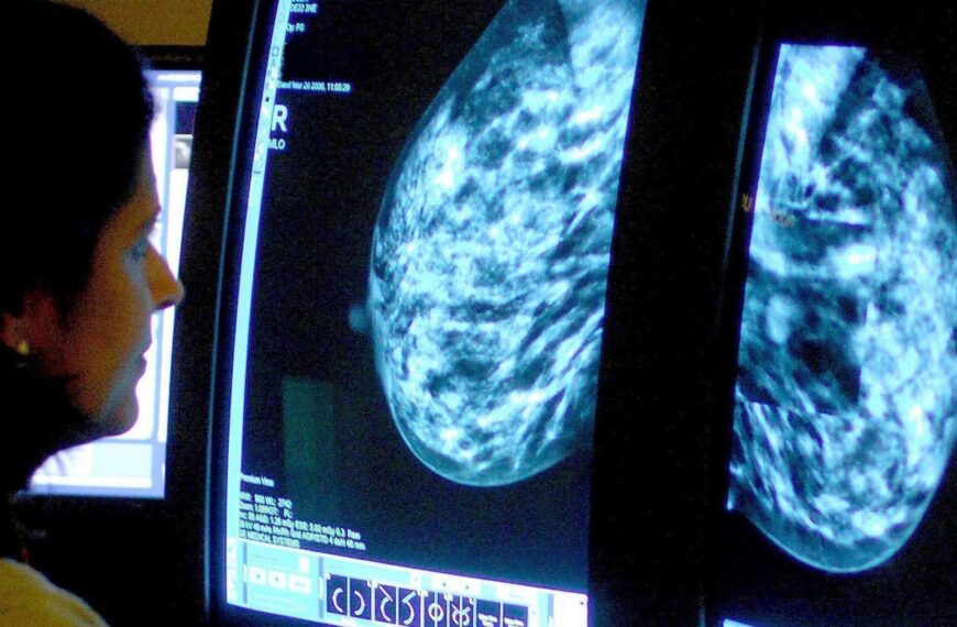 AI-assisted mammograms result in fewer aggressive and advanced breast cancers, study suggests