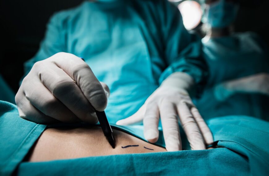 Brazilian butt lifts ‘should be banned immediately’ by government, MPs say