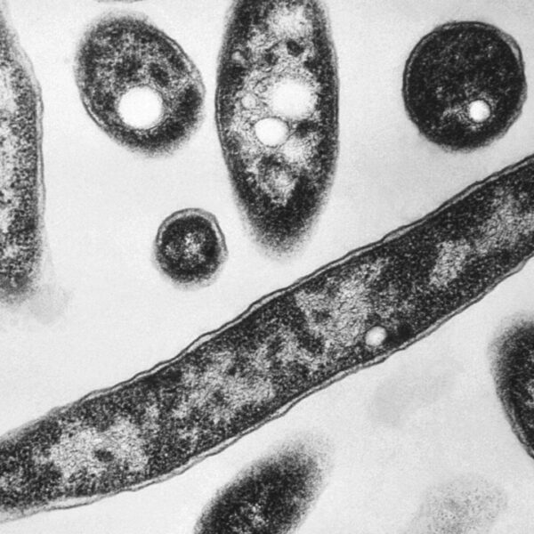 UK health agency investigating London legionnaires’ disease cluster