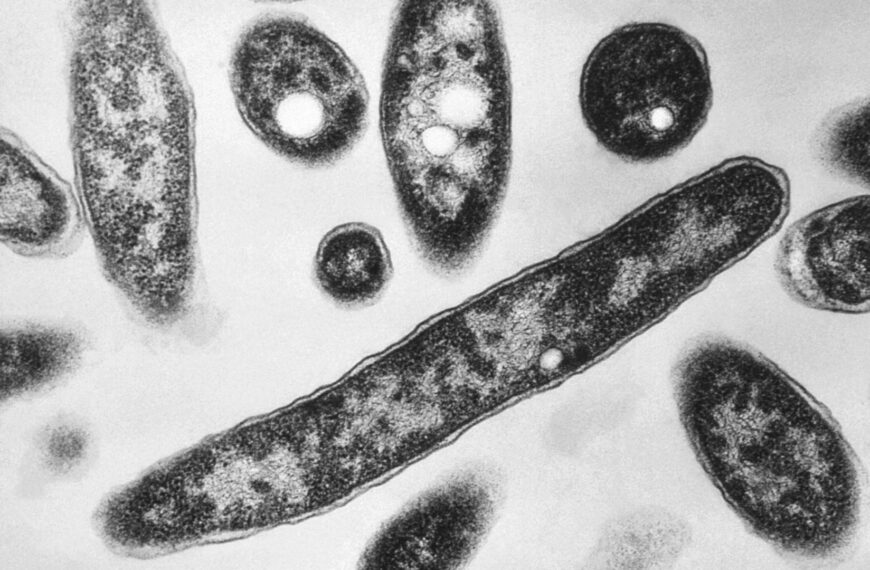 UK health agency investigating London legionnaires’ disease cluster